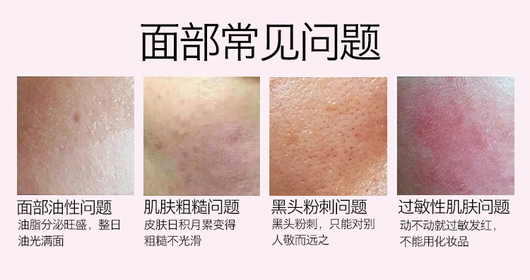 硅膠洗臉?biāo)?硅膠章魚洗臉?biāo)?硅膠潔面刷,硅膠洗臉神器 硅膠洗臉?biāo)?硅膠章魚洗臉?biāo)?硅膠潔面刷,硅膠洗臉神器